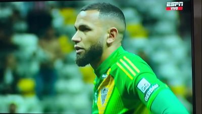 Portero de Equipo Brasilero VACUNA a Pequeña Venezolana (creo)